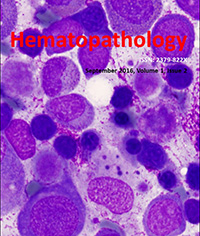 EBV-positive gastric plasmablastic lymphoma in an HIV-negative adult