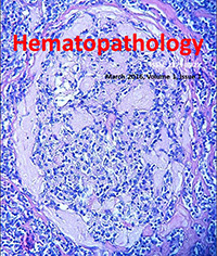 Systemic mastocytosis with associated clonal hematologic non-mast cell lineage disease (SM-AHNMD) involving chronic myelogenous leukemia with complex cytogenetics: A case report and literature review