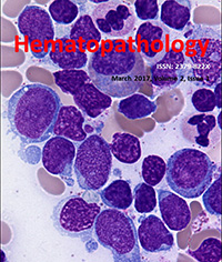 Diagnostic challenge: Acute leukemia with biphenotypic blasts and BCR-ABL1 translocation