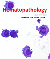 Extramedullary hematopoiesis manifesting as pleural effusion in a patient with post-polycythemic myelofibrosis